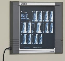Imaging/Radiology: Model SKU: qmewolfxrayviewers Imaging/Radiology: Model SKU: qmewolfxrayviewers